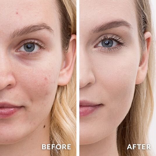 Image result for Pore Concealer before after